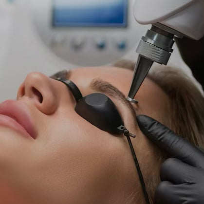 LASER OR LIQUID REMOVAL FOR COSMETIC BROW TATTOO (liquid for red or yellow pigment remnants)