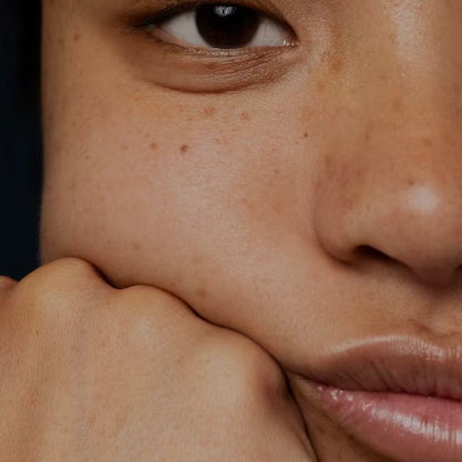 SKIN TEXTURE PROGRAM