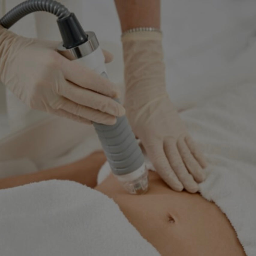RF MICRONEEDLING BODY