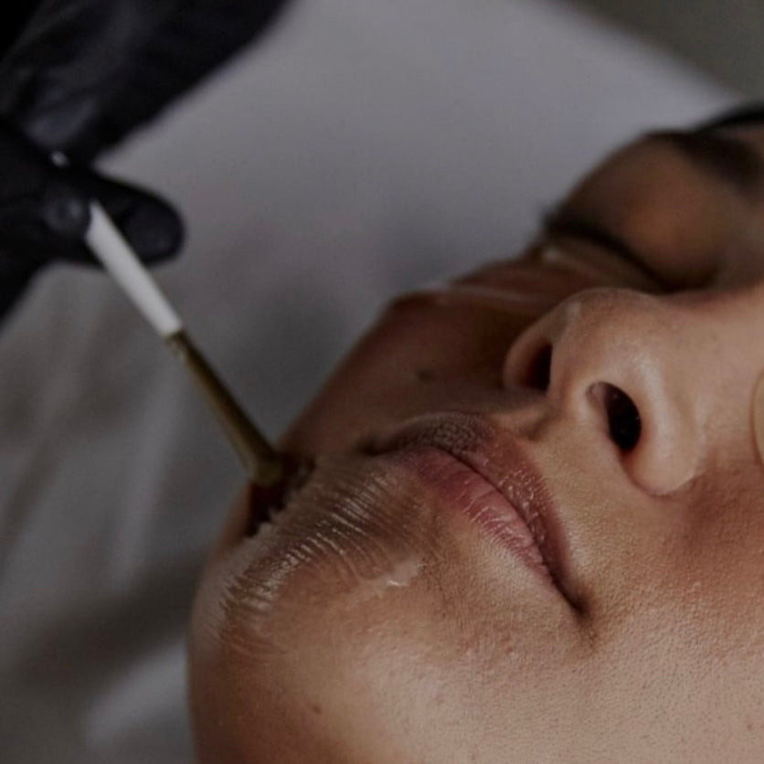 BIO C PEEL