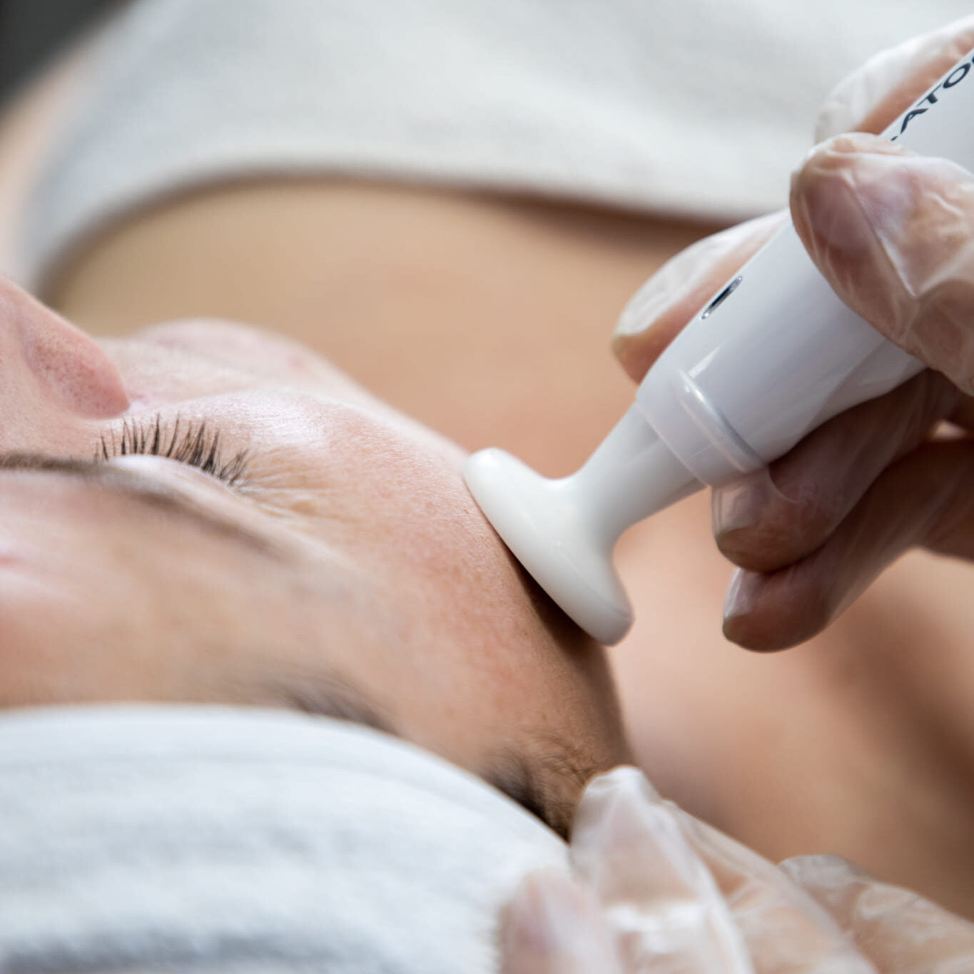 FACIALS & SOFT PEELS
