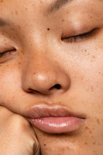 SKIN MICRONEEDLING & PEELS